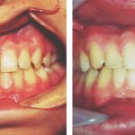 dental